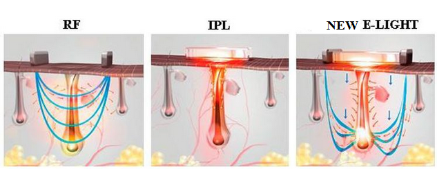 cong-nghe-anh-sang-new-e-light-triet-sach-long-tay-vui-don-tet.5