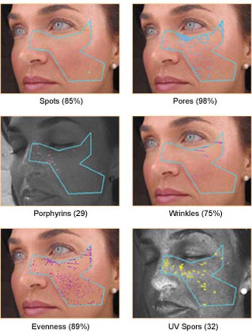 Kết quả hiện thị khi phân tích da bằng Visia