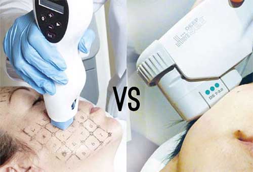 thermage và ultherapy