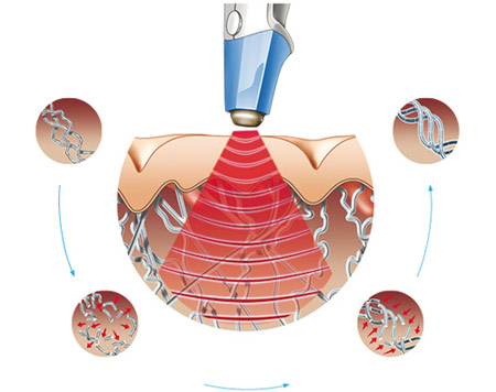 dung-de-chuyen-ay-ngai-ngung-3