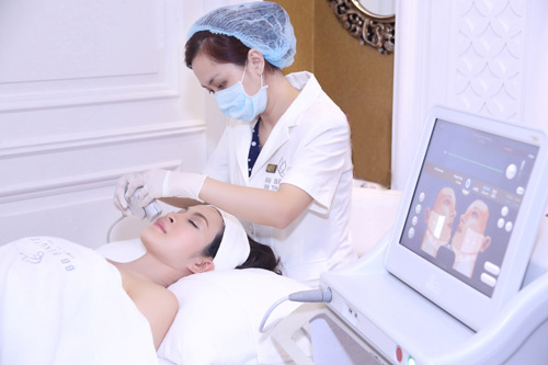 ultherapy-bb-thanh-mai