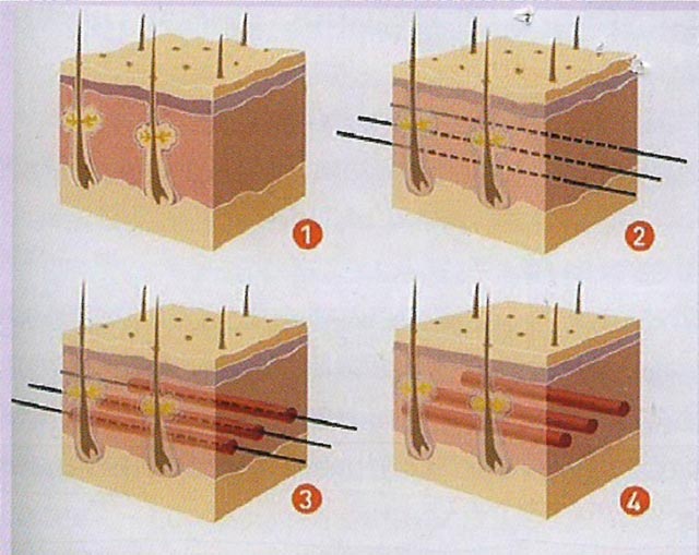 chi-colagen-hoat-dong