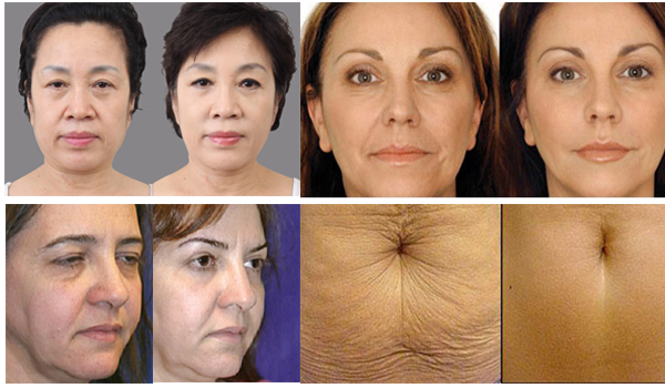 diem-my-lam-dep-tai-bbbeaute-6