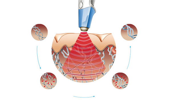 noi-am-anh-phu-nu-sau-sinh-3