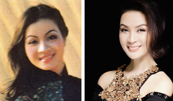 noi-am-anh-phu-nu-sau-sinh