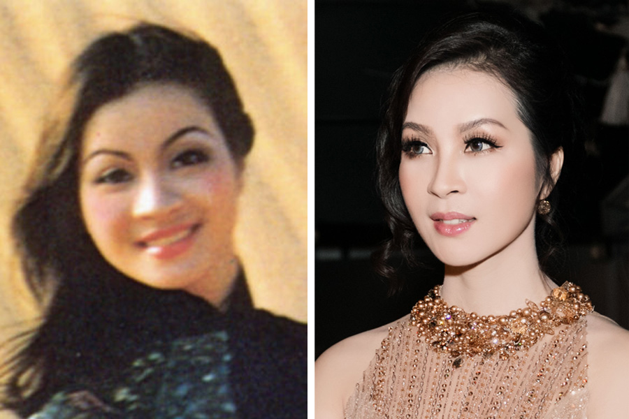 trẻ hóa da công nghệ Thermage