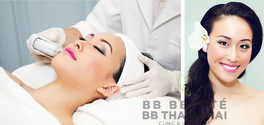 trẻ hóa Ultherapy