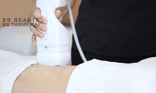 Giảm béo liposonix